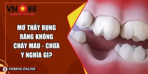 Mơ thấy rụng răng không chảy máu